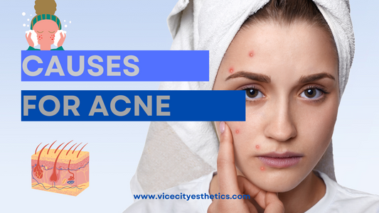 Causes For Acne